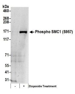SMC1, p Ser957 Antibody, Novus Biologicals 0.1mL; Unlabeled:Antibodies,